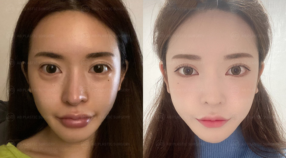 AB Plastic Surgery